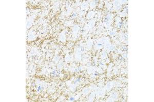 Immunohistochemistry of paraffin-embedded rat brain using CNP antibody.