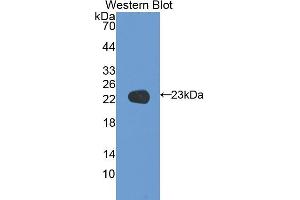 Western blot analysis of the recombinant protein. (Coagulation Factor V anticorps  (AA 1941-2095))