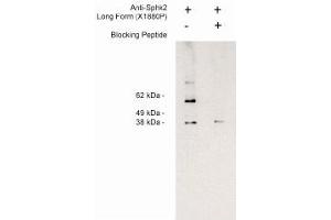 Image no. 1 for anti-Sphingosine Kinase 2 (SPHK2) (Long Isoform), (N-Term) antibody (ABIN4620350) (SPHK2 anticorps  (Long Isoform, N-Term))