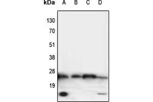 Western blot analysis of TNF alpha expression in HeLa (A), NIH3T3 (B), mouse heart (C), rat brain (D) whole cell lysates. (TNF alpha anticorps  (Center))