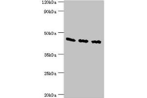 Western blot All lanes: Flotillin-2 antibody at 4 μg/mL Lane 1: A549 whole cell lysate Lane 2: Hela whole cell lysate Lane 3: Rat brain tissue Secondary Goat polyclonal to rabbit IgG at 1/10000 dilution Predicted band size: 47 kDa Observed band size: 47 kDa (Flotillin 2 anticorps  (AA 239-428))