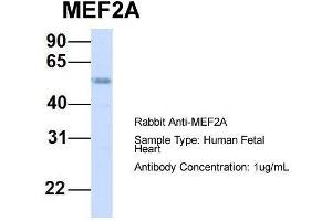 Host:  Rabbit  Target Name:  MEF2A  Sample Type:  Human Fetal Heart  Antibody Dilution:  1. (MEF2A anticorps  (Middle Region))