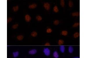 Immunofluorescence analysis of U-2 OS cells using GLI2 Polyclonal Antibody at dilution of 1:100. (GLI2 anticorps)