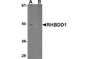 Western blot analysis of RHBDD1 in K562 cell lysate with RHBDD1 antibody at 1 µg/mL in (A) the absence and (B) the presence of blocking peptide. (RHBDD1 anticorps  (C-Term))