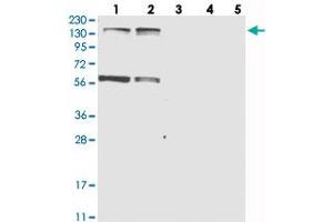 Western blot analysis of Lane 1: RT-4, Lane 2: U-251 MG, Lane 3: Human Plasma, Lane 4: Liver, Lane 5: Tonsil with KIF4A polyclonal antibody  at 1:250-1:500 dilution. (KIF4A anticorps)