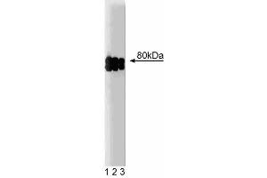 Western blot analysis of CLA-1 on a HeLa cell lysate (Human cervical epitheloid carcinoma, ATCC CCL-2. (SCARB1 anticorps  (AA 104-294))