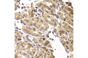 Immunohistochemistry of paraffin-embedded human gastric injury using ASMTL antibody (ABIN5975463) at dilution of 1/100 (40x lens). (ASMTL anticorps)