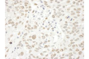 anti-RBP1-like protein (ARID4B) (AA 125-175) antibody