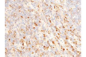 ABIN6267224 at 1/100 staining human appendiceal tissue sections by IHC-P.