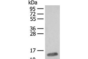 Western blot analysis of Mouse heart tissue lysate using FABP4 Polyclonal Antibody at dilution of 1:400 (FABP4 anticorps)