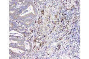 IHC analysis of RRBP1 using anti-RRBP1 antibody (ABIN6719628).