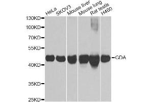 Western blot analysis of extracts of various cell lines, using GDA Antibody. (GDA anticorps  (AA 165-454))