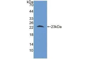 Detection of Recombinant STIP1, Human using Polyclonal Antibody to Stress Induced Phosphoprotein 1 (STIP1) (STIP1 anticorps  (AA 1-169))