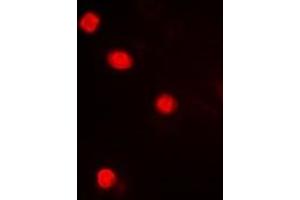 Immunofluorescent analysis of MAPKAPK3 staining in Hela cells. (MAPKAP Kinase 3 anticorps  (C-Term))