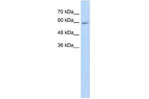 CYP4F11 antibody used at 5 ug/ml to detect target protein.