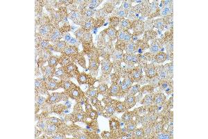 Immunohistochemistry of paraffin-embedded mouse liver using Haptoglobin (Haptoglobin (HP)) antibody (ABIN3022157, ABIN3022158, ABIN1513029, ABIN1514188 and ABIN6218636) at dilution of 1:100 (40x lens). (Haptoglobin anticorps)