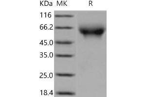Western Blotting (WB) image for Poliovirus Receptor (PVR) (Active) protein (His tag) (ABIN7321243)