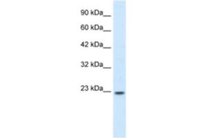 Western Blotting (WB) image for anti-Homeobox B6 (HOXB6) antibody (ABIN2460208) (HOXB6 anticorps)