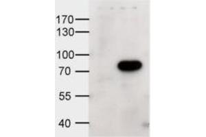 Western Blotting (WB) image for anti-ATP-Binding Cassette, Sub-Family D (Ald), Member 1 (ABCD1) (Internal Region) antibody (ABIN2465335) (ABCD1 anticorps  (Internal Region))