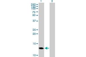 Western Blot analysis of CMTM1 expression in transfected 293T cell line by CMTM1 MaxPab polyclonal antibody.