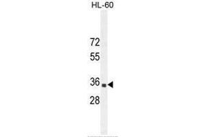 B3GNT4 Antaibody (Center) western blot analysis in HL-60 cell line lysates (35µg/lane). (B3GNT4 anticorps  (Middle Region))