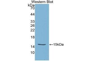 Detection of Recombinant HTRA1, Escherichia coli using Polyclonal Antibody to High Temperature Requirement Factor A1 (HTRA1)