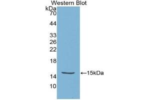 Detection of Recombinant HTRA1, Escherichia coli using Polyclonal Antibody to High Temperature Requirement Factor A1 (HTRA1) (High Temperature Requirement Factor A1 (AA 304-442) anticorps)