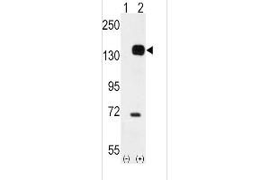 Western blot analysis of TEK (arrow) using rabbit polyclonal TEK Antibody (C-term) (ABIN392059 and ABIN2841824). (TEK anticorps  (C-Term))
