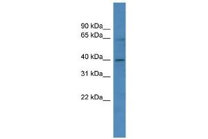WB Suggested Anti-ZNF579 Antibody Titration:  0. (ZNF579 anticorps  (C-Term))