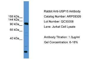 WB Suggested Anti-USP15  Antibody Titration: 0. (USP15 anticorps  (C-Term))
