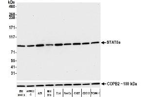 Western Blotting (WB) image for anti-Signal Transducer and Activator of Transcription 5A (STAT5A) (AA 744-794) antibody (ABIN7454017) (Recombinant STAT5A anticorps  (AA 744-794))