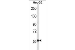 Western blot analysis in HepG2 cell line lysates (35ug/lane). (Sp3 anticorps  (AA 292-321))