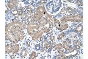 anti-Signal Sequence Receptor, alpha (SSR1) (N-Term) antibody