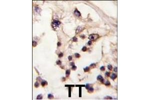 Formalin-fixed and paraffin-embedded human testis tissue reacted with TESK2 antibody (Center) f , which was peroxidase-conjugated to the secondary antibody, followed by DAB staining.