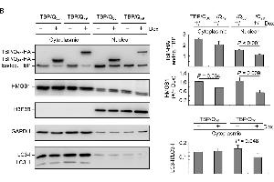ROS and HMGB1 distribution in starvation-stressed TBP/Q36~79 293 cells. (Histone H3.3B anticorps  (full length))