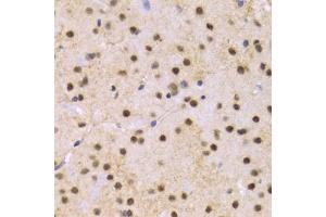 Immunohistochemistry of paraffin-embedded mouse brain using SNRPE Antibody (ABIN1876676) at dilution of 1:100 (40x lens). (SNRPE anticorps)