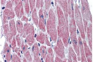 Human Heart: Formalin-Fixed, Paraffin-Embedded (FFPE)