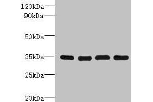 Western blot All lanes: DNAJC17 antibody at 16 μg/mL Lane 1: A431 whole cell lysate Lane 2: Hela whole cell lysate Lane 3: Raji whole cell lysate Lane 4: HepG2 whole cell lysate Secondary Goat polyclonal to rabbit IgG at 1/10000 dilution Predicted band size: 35 kDa Observed band size: 35 kDa (DNAJC17 anticorps  (AA 1-304))