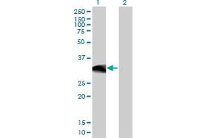 Western Blot analysis of BCL11A expression in transfected 293T cell line by BCL11A monoclonal antibody (M03), clone 3D9. (BCL11A anticorps  (AA 1-88))