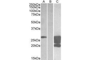 HEK293 lysate (10 µg protein in RIPA buffer) overexpressing Human GM2A with DYKDDDDK tag probed with AP23748PU-N (1. (GM2A anticorps  (Internal Region))