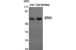Western Blot (WB) analysis of specific cells using ER81 Polyclonal Antibody. (ETV1 anticorps  (N-Term))