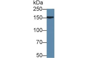 Detection of APOB in Rat Liver lysate using Polyclonal Antibody to Apolipoprotein B (APOB)
