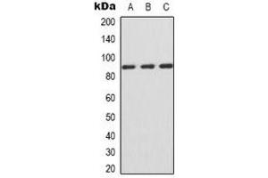 Western blot analysis of IFNGR1 expression in Jurkat (A), HepG2 (B), COS7 (C) whole cell lysates. (IFNGR1 anticorps  (C-Term))