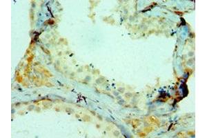 Immunohistochemistry of paraffin-embedded human testis tissue using ABIN7148221 at dilution of 1:100 (COL1A1 anticorps  (AA 521-680))