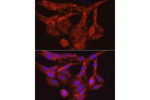 Immunofluorescence analysis of PC-12 cells using PPP1R12A Rabbit pAb (ABIN6128260, ABIN6146059, ABIN6146061 and ABIN6213896) at dilution of 1:100 (40x lens).