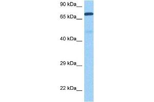 Host:  Rabbit  Target Name:  MMP9  Sample Tissue:  Human Ovary Tumor  Antibody Dilution:  1ug/ml