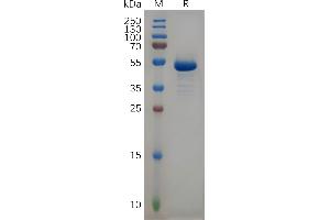 Human CD99 Protein, hFc Tag on SDS-PAGE under reducing condition.
