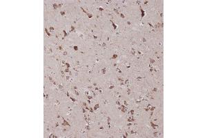 Immunohistochemical analysis of C on paraffin-embedded Human brain tissue was performed on the Leica®BOND RXm. (CBS anticorps  (AA 301-330))