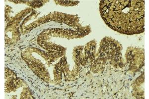 ABIN6276466 at 1/100 staining Mouse colon tissue by IHC-P. (MTAP anticorps  (Internal Region))