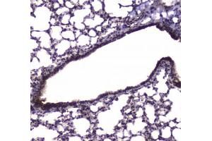 IHC testing of FFPE mouse lung tissue with NFIB antibody at 1ug/ml. (NFIB anticorps)